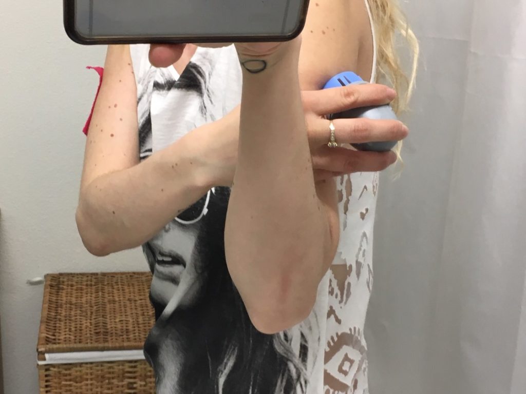 Bild von Daphne Chaimovitz, Diabetes