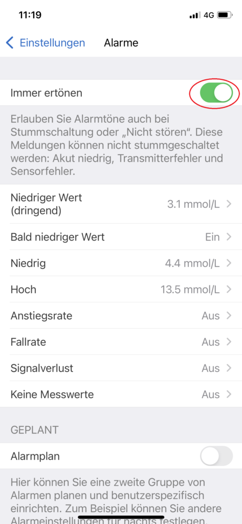 Bild der Dexcom-Einstellungen an einer Pressevisionierung